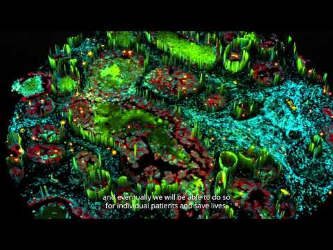 Built with Qt: QIS revolutionizing cancer research with KDAB